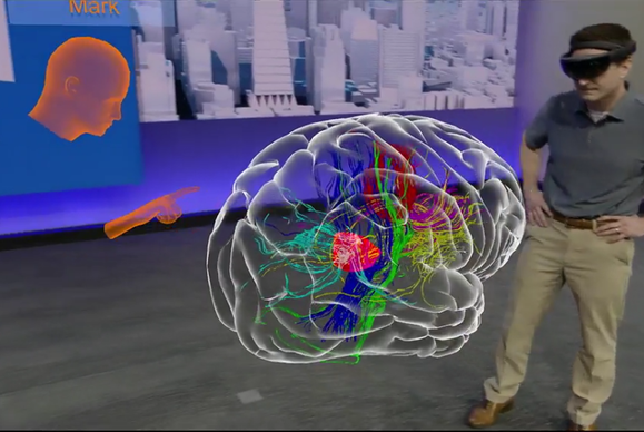 hololens build 2016 medical application mark remote user